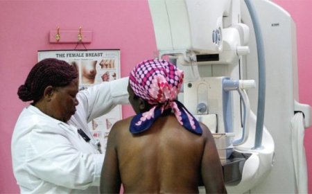 Dore imibare ifatika y’abarwayi ba Cancer bivurije mu bitaro bya Butaro