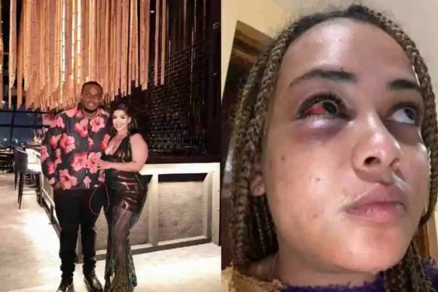 Yamaze imyaka 10 akubitwa n'umugabo nk'inyamaswa!Salima yashyize hanze iby’inkoni yakubitwaga n’umugabo we[AMAFOTO]