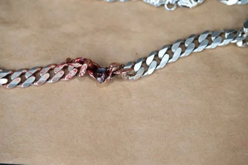 Habuze gato ngo apfe!: Umugabo yarokotse isasu akingiwe n’umukufi yari yambaye mu ijosi