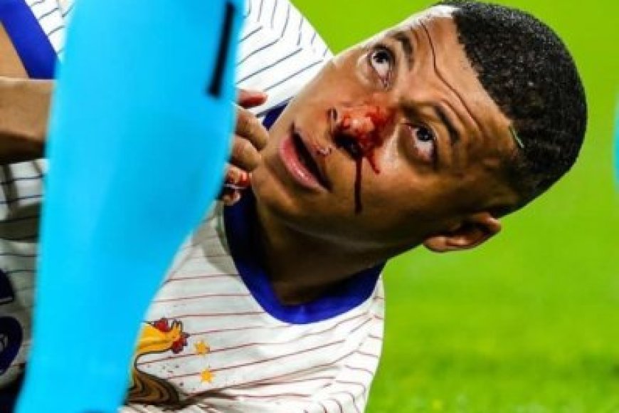 Rutahizamu ukomeye cyane Kylian Mbappe  hamenyekanye icyemezo cyafashwe nyuma yo kuvunika izuru