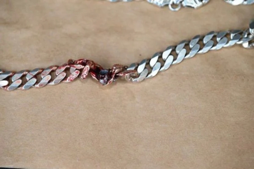 Habuze gato ngo apfe!: Umugabo yarokotse isasu akingiwe n’umukufi yari yambaye mu ijosi