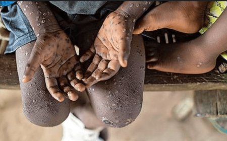 Icyorezo gikomeje kuvuza ubuhuha mu bihugu bitandukanye kugeza nubwo ubungubu cyageze muri Kenya