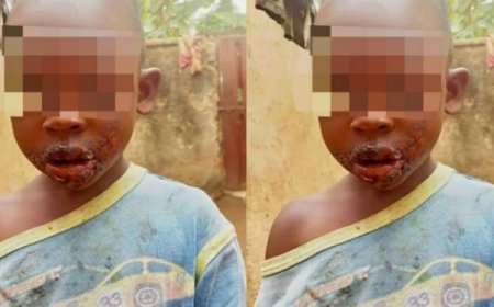 Kamonyi: Umubyeyi yafunzwe azira gutwika umunwa w’umwana yibyariye akoresheje umuhoro yabanje gucana ugatukura