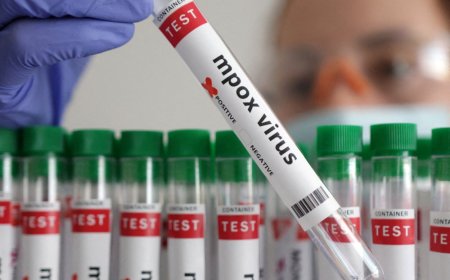 Uganda: Hagaragaye abandi bantu babiri banduye virusi y’Ubushita bw’Inkende