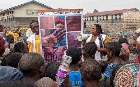 Icyorezo n'inzara birimo kuvuza ubuhuha muri Congo kubera abarwayi ba ‘Monkeypox’ bari gutoroka ibitaro kubera inzara