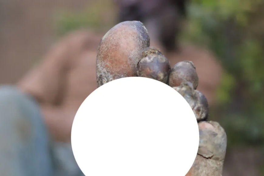 Umusore ubayeho mubuzima bubi cyane wo mu karere ka Rubavu aratabarizwa n'abaturanyi