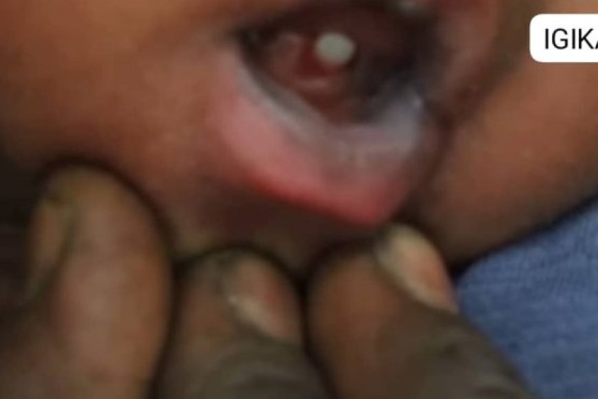 Kamwe mu turere tw' u Rwanda haravugwa inkuru y'uruhinja rwavukanye amenyo