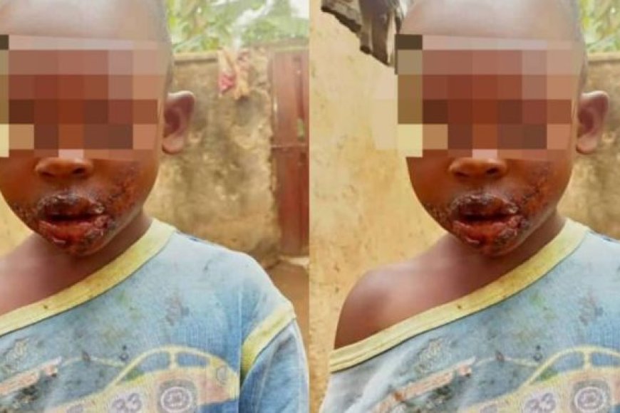 Kamonyi: Umubyeyi yafunzwe azira gutwika umunwa w’umwana yibyariye akoresheje umuhoro yabanje gucana ugatukura