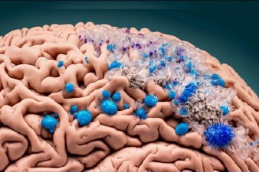 Ubushakashatsi bw'abahanga bugaragaza ko ubwonko bw’ikiremwamuntu buri kwivanga na Pulasitiki ku kigero cyo hejuru