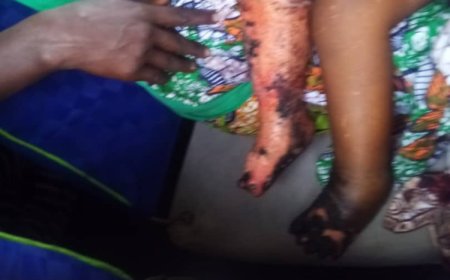 Nyanza: Mugahinda n'ikiniga umubyeyi aratabaza nyuma y’uko umwana we atwitswe n’umuntu bavuga ko ari umukire nta muntu wamukoraho