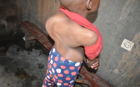 Burera: Umubyeyi aratabariza umwana we ufite urutirigongo rwahetamye akaba asabwa miliyoni 15 Frw yo kuvuza umwana we