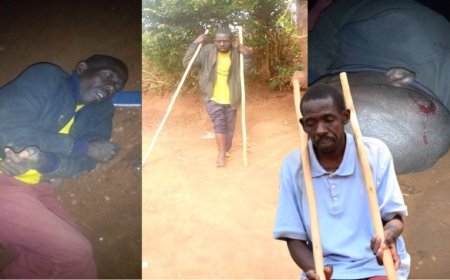 Nyamirambo: Aratabaza nyuma yo gukubitwa n’abanyerondo akaba arikwihagarika amaraso(VIDEO)