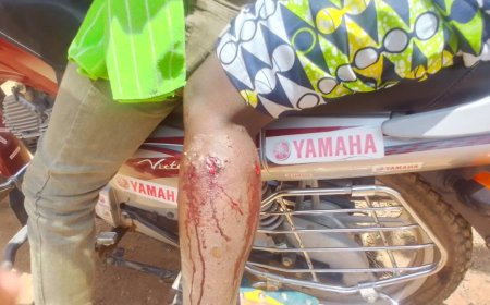 Nyamasheke: Umugore yahuye nuruva gusenya nyuma yuko imbwa z’umuturanyi zamusanze mu murima ahinga zikamurya