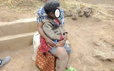 Burera: Umubyeyi avuga ko akeneye miliyoni 5 kugira ngo avuze umwana we wavukanye ubumuga bw’akaguru