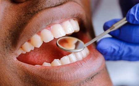 Umugabo yakuwe amenyo 23 aterwamo n’andi 12 ku munsi umwe birangira apfuye