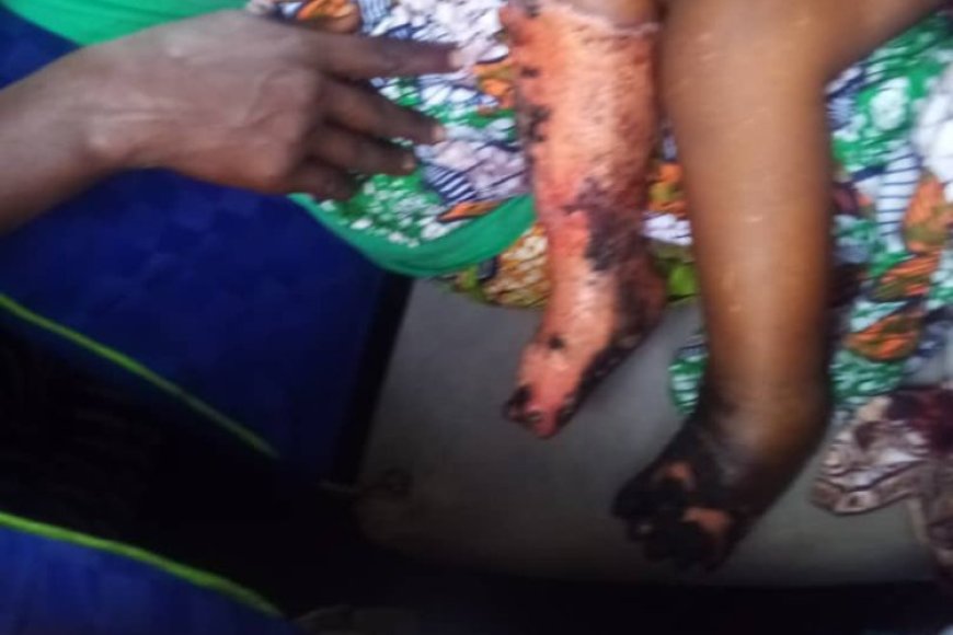 Nyanza: Mugahinda n'ikiniga umubyeyi aratabaza nyuma y’uko umwana we atwitswe n’umuntu bavuga ko ari umukire nta muntu wamukoraho