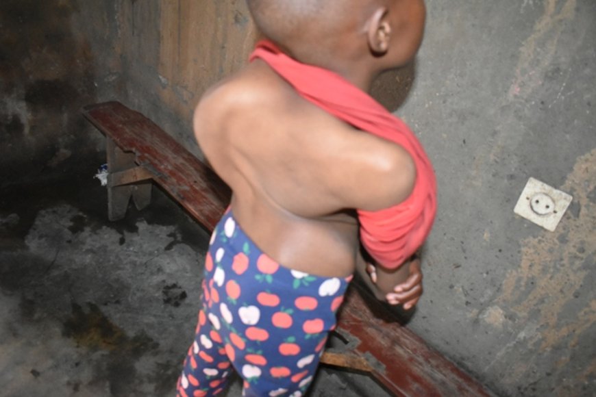 Burera: Umubyeyi aratabariza umwana we ufite urutirigongo rwahetamye akaba asabwa miliyoni 15 Frw yo kuvuza umwana we