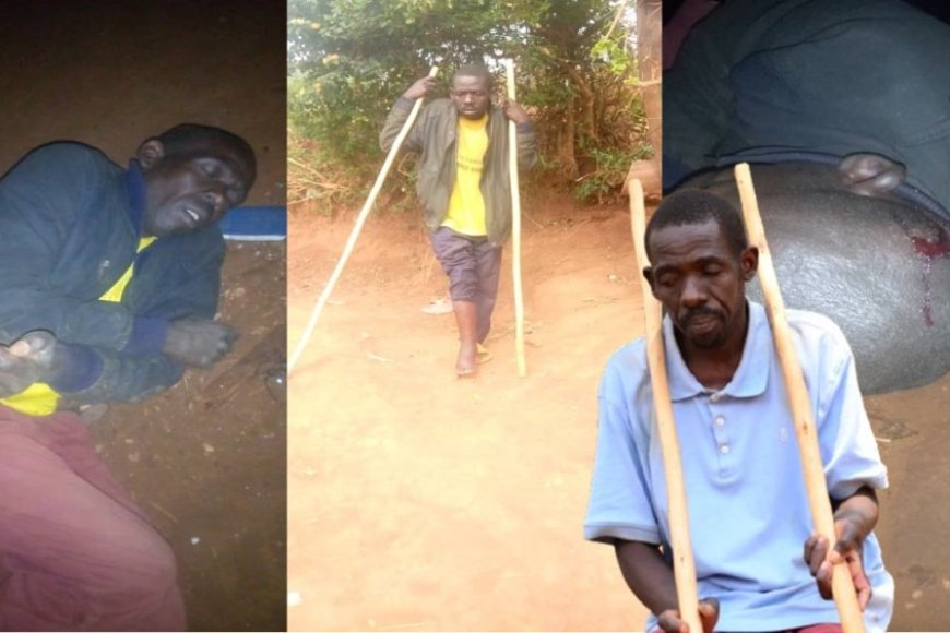 Nyamirambo: Aratabaza nyuma yo gukubitwa n’abanyerondo akaba arikwihagarika amaraso(VIDEO)