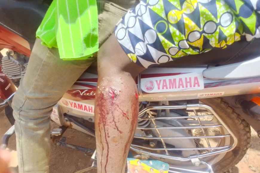 Nyamasheke: Umugore yahuye nuruva gusenya nyuma yuko imbwa z’umuturanyi zamusanze mu murima ahinga zikamurya