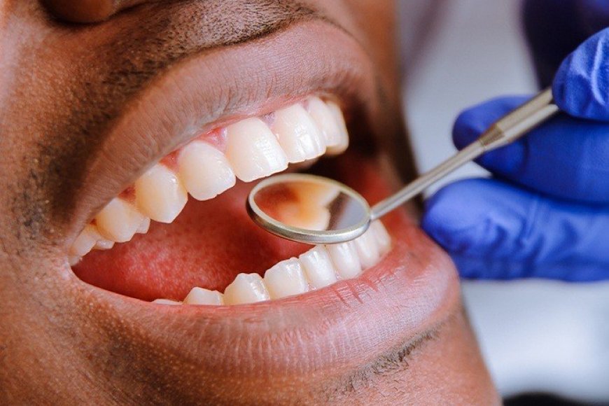 Umugabo yakuwe amenyo 23 aterwamo n’andi 12 ku munsi umwe birangira apfuye