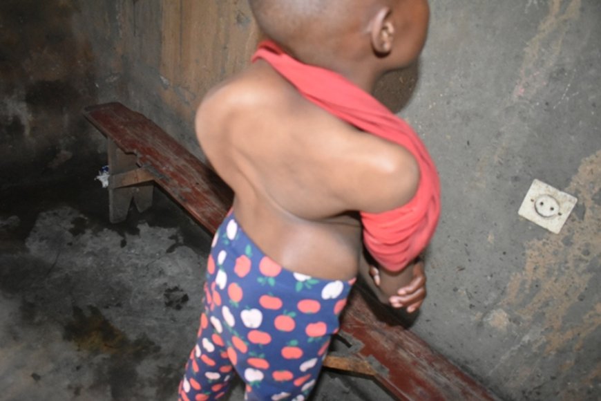 Burera: Umubyeyi aratabariza umwana we ufite urutirigongo rwahetamye akaba asabwa miliyoni 15 Frw yo kuvuza umwana we