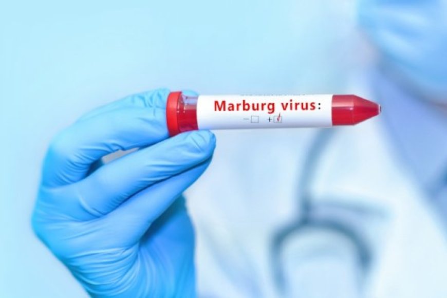 Amakuru meza ku bari barwaye Icyorezo cya Marburg bose