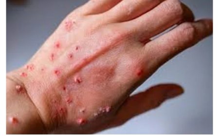 Igihugu abantu byakunda cyane Habonetsemo abantu  bafite virusi yatumaga abanyarwanda bataryama