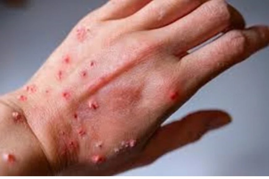 Igihugu abantu byakunda cyane Habonetsemo abantu  bafite virusi yatumaga abanyarwanda bataryama