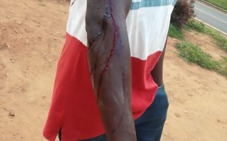 Nyamasheke: Umugore ari guhigishwa uruhindu nyuma yo gutera umugabo we icyuma bapfa telefone