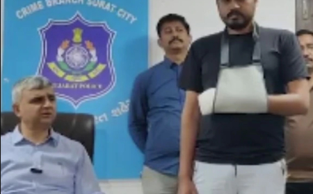 Umugabo akomeje kuvugisha benshi nyuma yo kwica intoki enye zose kugirango abone uko areka akazi