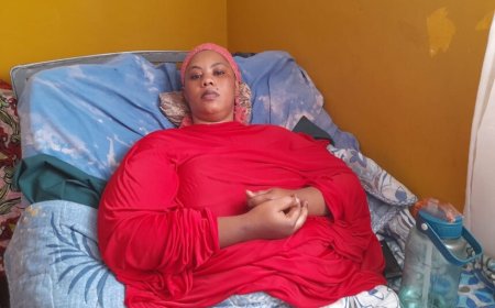 Niba ufite umutima ufasha mufashe kuko arasaba ubufasha : Umugore umaze imyaka 10 arwariye mu Bitaro arasaba ubufasha