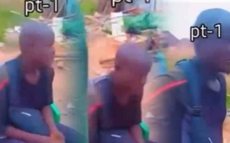 Bikomeje kuba agaterera nzamba! Umugabo yabyutse mugitondo nkibisanzwe asanga igitsina cye cyazimiye