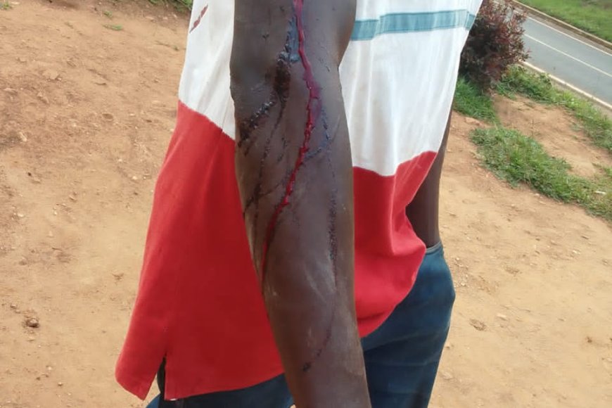 Nyamasheke: Umugore ari guhigishwa uruhindu nyuma yo gutera umugabo we icyuma bapfa telefone