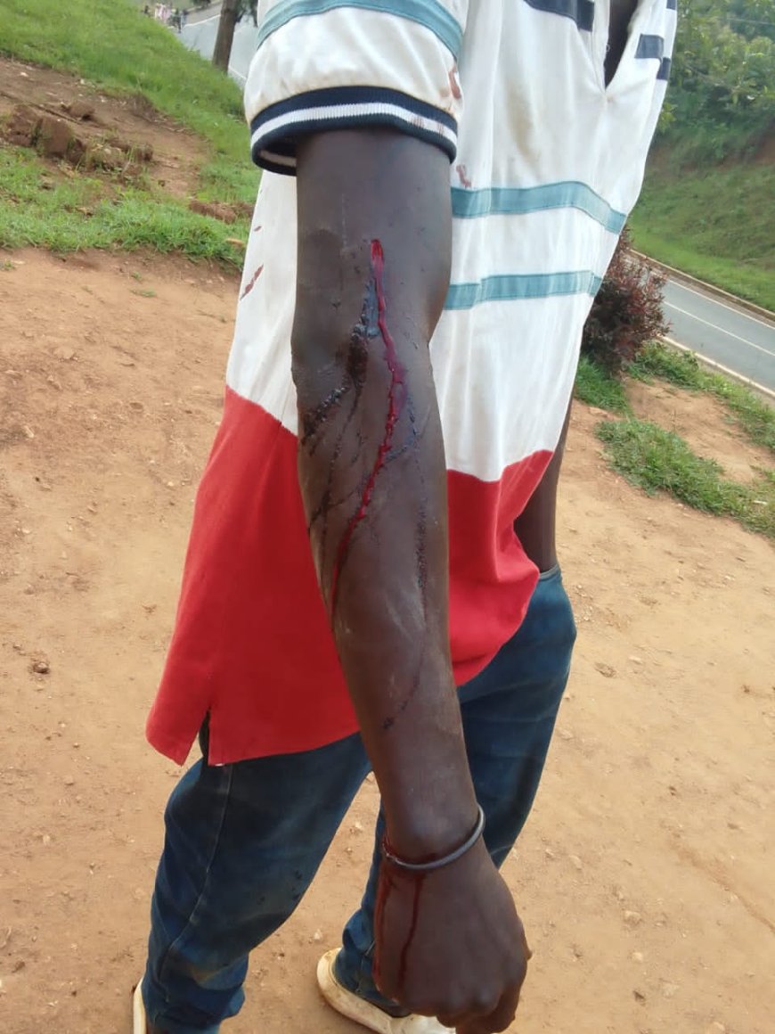 Nyamasheke: Umugore ari guhigishwa uruhindu nyuma yo gutera umugabo we icyuma bapfa telefone