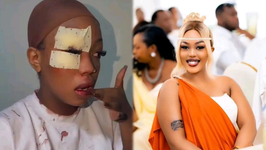 Bianca wa Sk Fm yarokotse impanuka ikomeye mu minsi ishize