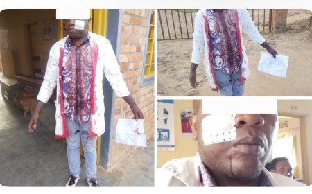 Gakenke: Umwarimu yajombwe ikaramu n’umunyeshuri akomereka bikabije