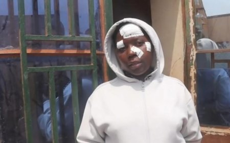 Burera:Umuturage arashinja Gitifu kumukubitira icupa mu kabari akamukomeretsa