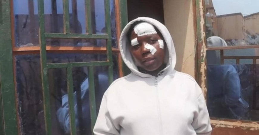 Burera:Umuturage arashinja Gitifu kumukubitira icupa mu kabari akamukomeretsa